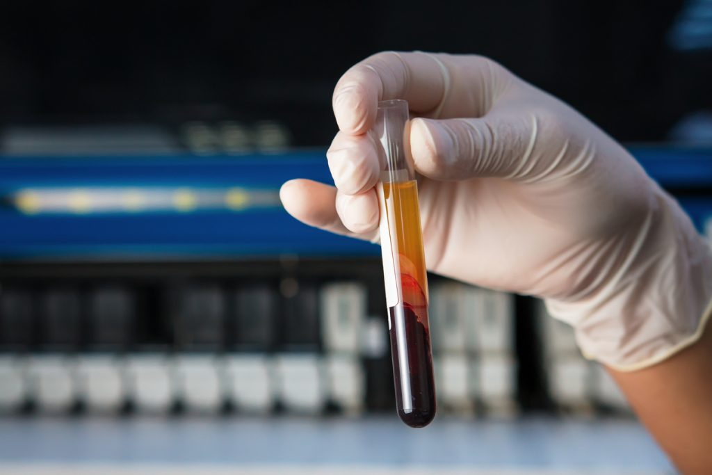 vial of blood help by a hand wearing disposable gloves