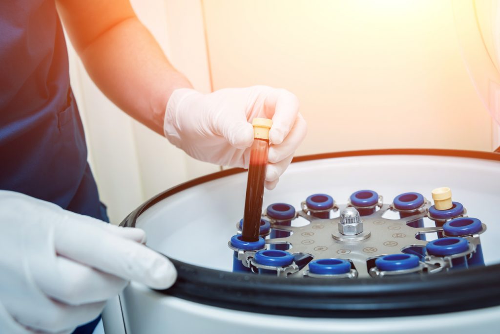 a vial of blood being placed in a spinner with other vials