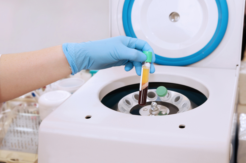 A vial of separated blood after spinning in a centrifuge machine