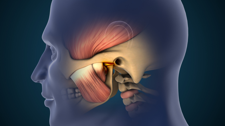 TMJ (temporomandibular joint) disorders causing jaw pain and inflammation.